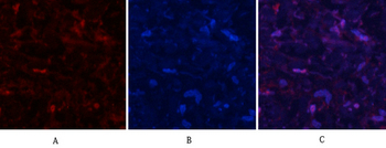 MYPT1 (phospho Thr853) Polyclonal Antibody