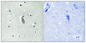 c-Kit (phospho Tyr936) Polyclonal Antibody