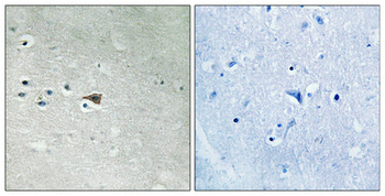 Arrestin-β-1 (phospho Ser412) Polyclonal Antibody