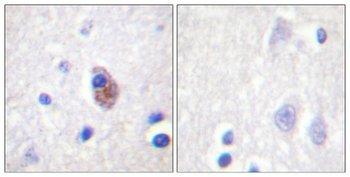PYK2 (phospho Tyr881) Polyclonal Antibody