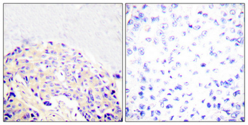 PLC γ1 (phospho Tyr771) Polyclonal Antibody