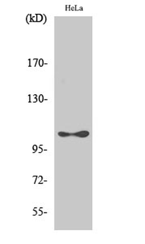 eEF2K (phospho Ser366) Polyclonal Antibody