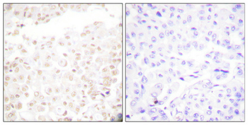 Cdk2/Cdc2 (phospho Thr160) Polyclonal Antibody