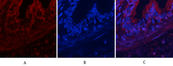 Akt (phospho Thr308) Polyclonal Antibody