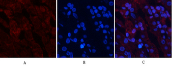 Akt (phospho Thr308) Polyclonal Antibody