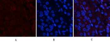 Akt (phospho Thr308) Polyclonal Antibody