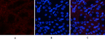 Akt (phospho Thr308) Polyclonal Antibody