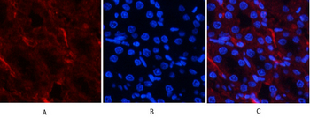 Akt (phospho Thr308) Polyclonal Antibody