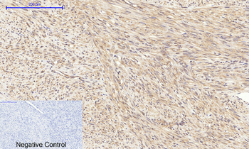 Akt (phospho Thr308) Polyclonal Antibody