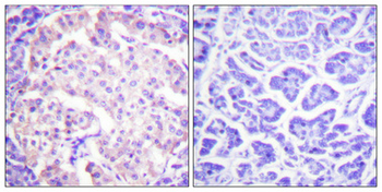 TH (phospho Ser62) Polyclonal Antibody
