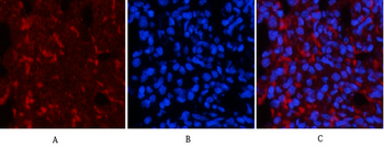 Smad3 (phospho Ser425) Polyclonal Antibody