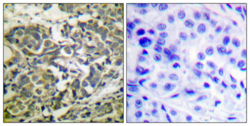 AMPKα1/2 (phospho Thr183/172) Polyclonal Antibody