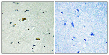 GRB10 (phospho Tyr67) Polyclonal Antibody