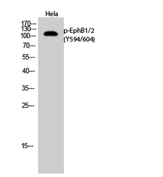 EphB1/2 (phospho Tyr594/604) Polyclonal Antibody