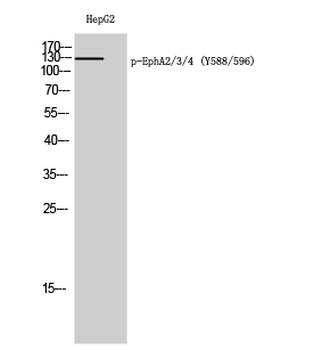 EphA2/3/4 (phospho Tyr588/596) Polyclonal Antibody