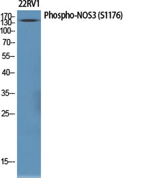 NOS3 (phospho Ser1177) Polyclonal Antibody