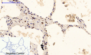 ERK 1/2 (phospho Tyr222/205) Polyclonal Antibody