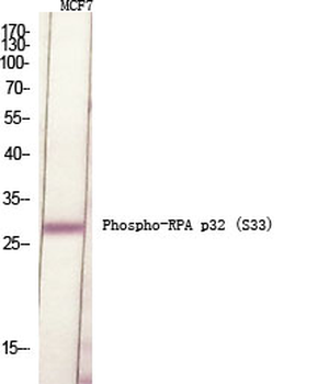 RPA p32 (phospho Ser33) Polyclonal Antibody
