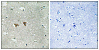 Lfc (phospho Ser885) Polyclonal Antibody