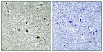 B23 (phospho Thr234) Polyclonal Antibody