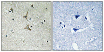Cdk5 (phospho Tyr15) Polyclonal Antibody