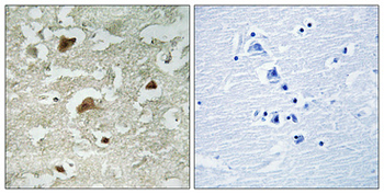 Smad3 (phospho Ser204) Polyclonal Antibody