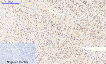 p38 (phospho Thr180/Y182) Polyclonal Antibody