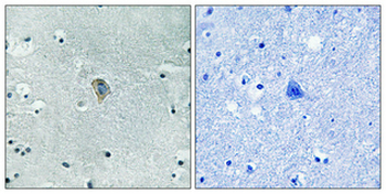 KOR-1 (phospho Ser369) Polyclonal Antibody