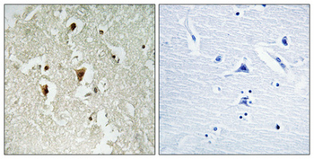 IκB-β (phospho Thr19) Polyclonal Antibody