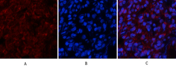 Tau (phospho Ser396) Polyclonal Antibody