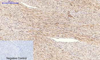 Tau (phospho Ser396) Polyclonal Antibody