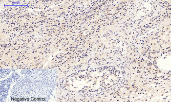 Stat3 (phospho Tyr705) Polyclonal Antibody