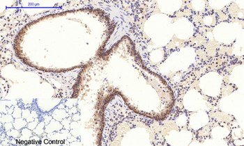 Stat3 (phospho Tyr705) Polyclonal Antibody