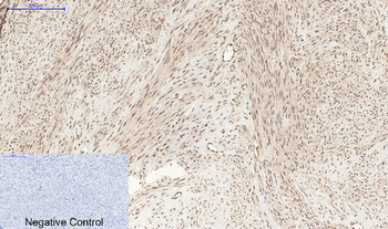 Stat3 (phospho Ser727) Polyclonal Antibody