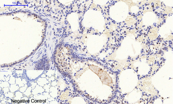 Stat1 (phospho Tyr701) Polyclonal Antibody