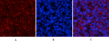 PI 3-kinase p85/p55 (phospho Tyr467/199) Polyclonal Antibody