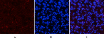 p53 (phospho Ser15) Polyclonal Antibody