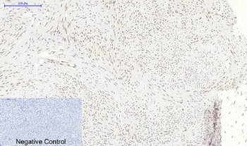 p38 (phospho Thr180) Polyclonal Antibody