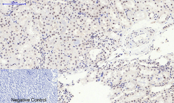 p38 (phospho Thr180) Polyclonal Antibody