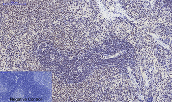 p38 (phospho Thr180) Polyclonal Antibody