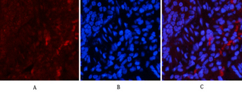 NFκB-p65 (phospho Ser536) Polyclonal Antibody