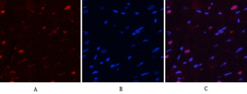 NFκB-p65 (phospho Ser529) Polyclonal Antibody