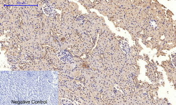 NFκB-p65 (phospho Ser276) Polyclonal Antibody