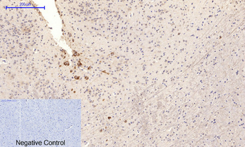 NFκB-p65 (phospho Ser276) Polyclonal Antibody