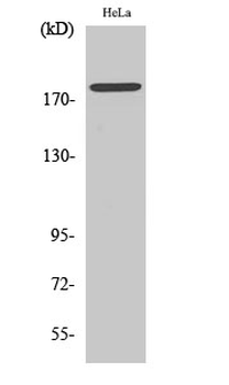 Neu (phospho Tyr877) Polyclonal Antibody