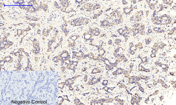 MEK-1/2 (phospho Ser218/222) Polyclonal Antibody