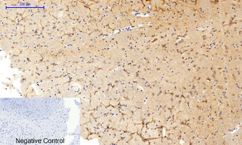MEK-1/2 (phospho Ser218/222) Polyclonal Antibody