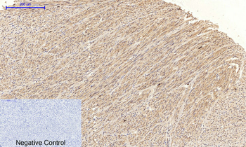 JNK1/2/3 (phospho Thr183/Y185) Polyclonal Antibody