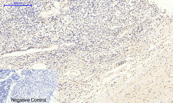 JAK2 (phospho Tyr1007) Polyclonal Antibody