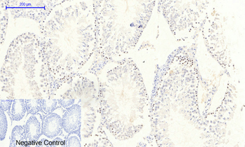 JAK2 (phospho Tyr1007) Polyclonal Antibody